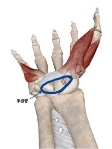 手首の痛みの原因手根管